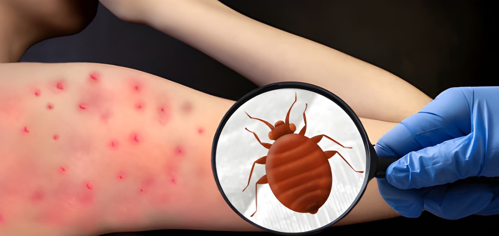 bed-bugs